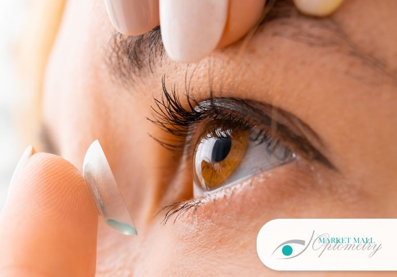 Specialty Contact Lenses for Astigmatism and Complex Vision Needs – Contact Lenses Calgary